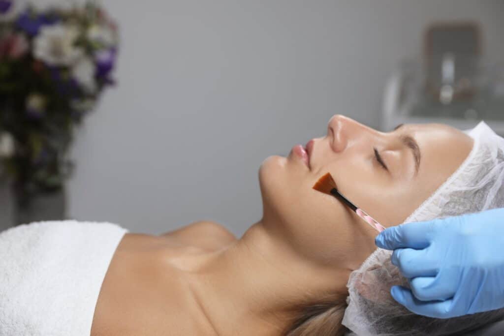 Chemical Peels procedure with a female patient